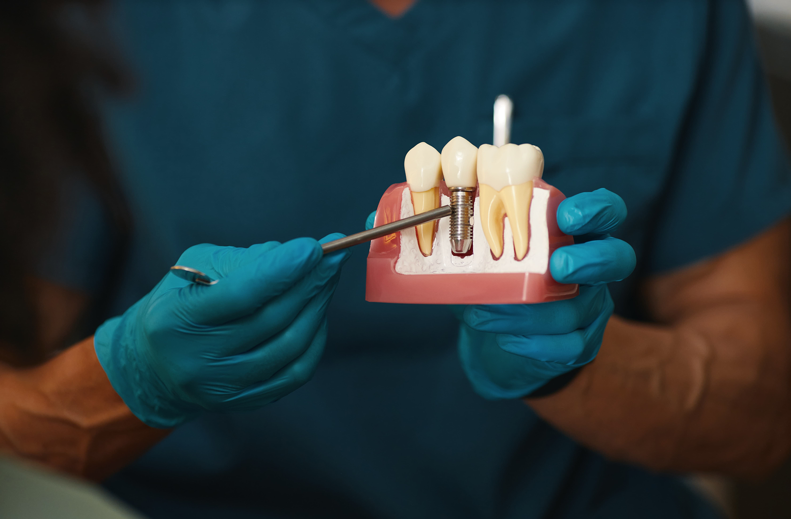 A dentist points at a model of teeth with dental implants.