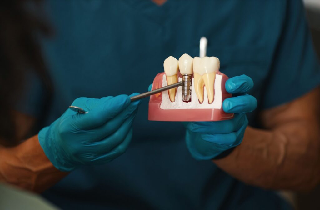 A dentist points at a model of teeth with dental implants.