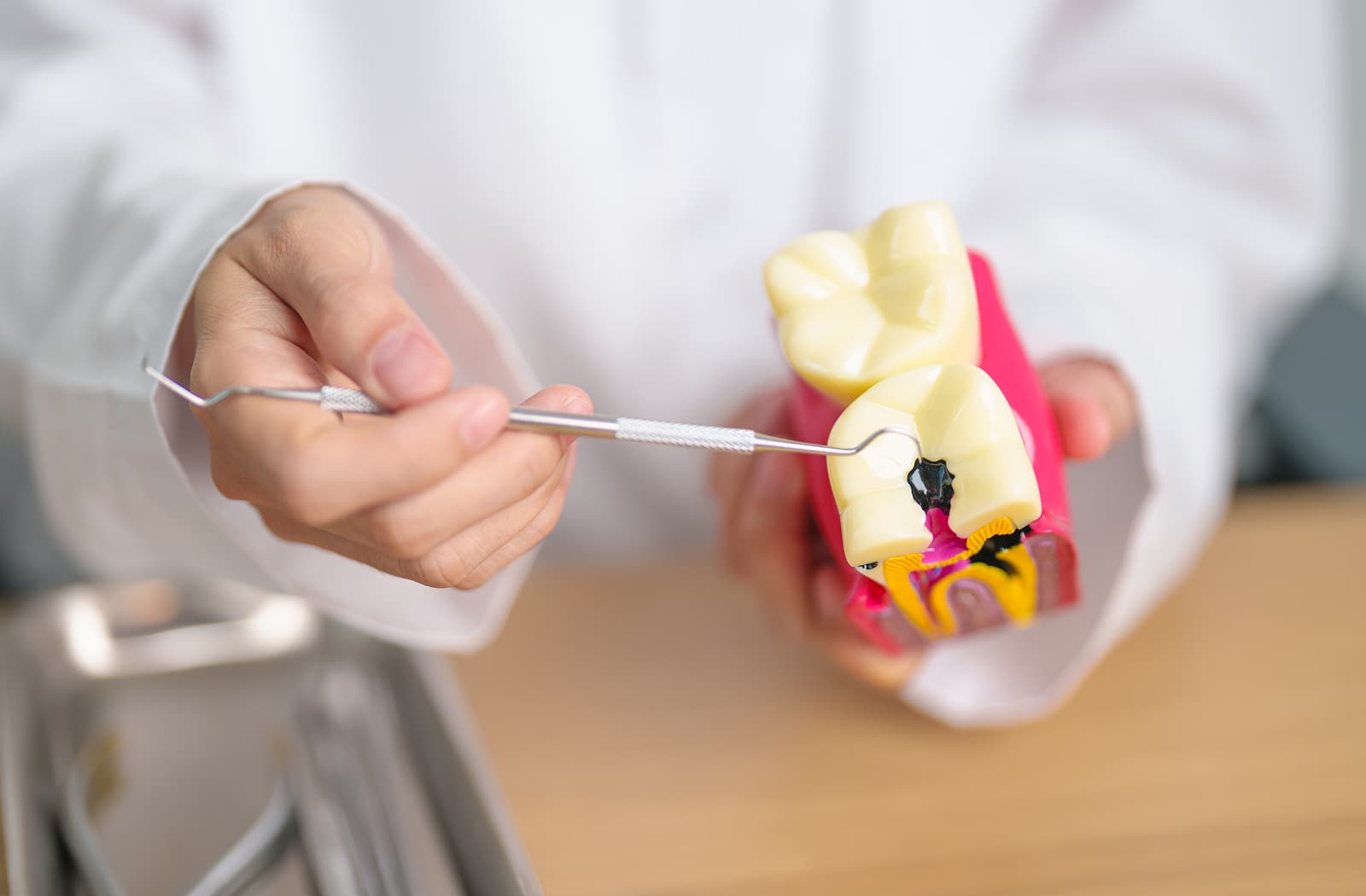 A dentist demonstrates how a tooth with a cavity is prepared for the filling using a dental model